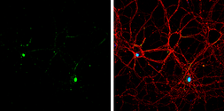 Anti-SATB2 antibody used in Immunocytochemistry/ Immunofluorescence (ICC/IF). GTX134135