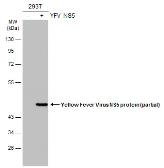 Anti-Yellow Fever virus NS5 protein antibody used in Western Blot (WB). GTX134141