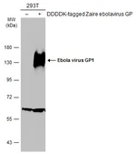 Anti-Ebola virus GP1 antibody used in Western Blot (WB). GTX134143