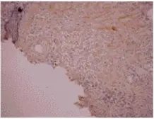 Anti-Osteocalcin antibody [OC4-30] used in IHC (Paraffin sections) (IHC-P). GTX13418