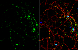 Anti-MADH7 antibody used in Immunocytochemistry/ Immunofluorescence (ICC/IF). GTX134232