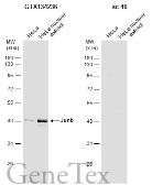 Anti-JunB antibody used in Western Blot (WB). GTX134236