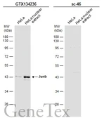 Anti-JunB antibody used in Western Blot (WB). GTX134236
