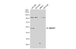 Anti-MADH7 antibody used in Western Blot (WB). GTX134260