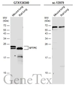 Anti-SFTPC antibody used in Western Blot (WB). GTX134340