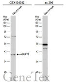 Anti-GNAT2 antibody used in Western Blot (WB). GTX134342