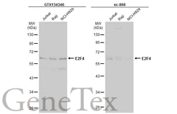Anti-E2F4 antibody used in Western Blot (WB). GTX134346