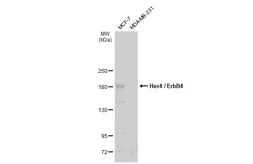 Anti-Her4 / ErbB4 antibody used in Western Blot (WB). GTX134351
