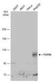 Anti-FGFR4 antibody used in Western Blot (WB). GTX134355