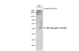 Anti-IRF3 (phospho Ser396) antibody used in Western Blot (WB). GTX134360