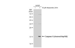 Anti-Caspase 6 (cleaved Asp162) antibody used in Western Blot (WB). GTX134362