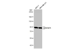 Anti-STAT1 antibody used in Western Blot (WB). GTX134371