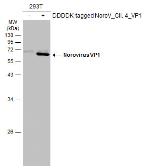 Anti-Norovirus VP1 antibody used in Western Blot (WB). GTX134380