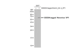 Anti-Norovirus VP1 antibody used in Western Blot (WB). GTX134381