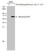 Anti-Norovirus VP1 antibody used in Western Blot (WB). GTX134382