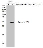 Anti-Norovirus VP2 antibody used in Western Blot (WB). GTX134386