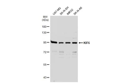 Anti-KIF6 antibody used in Western Blot (WB). GTX134401