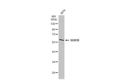 Anti-SOX10 antibody used in Western Blot (WB). GTX134405