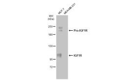 Anti-IGF1R antibody used in Western Blot (WB). GTX134417