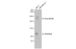 Anti-IGF1R beta antibody used in Western Blot (WB). GTX134417