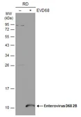 Anti-Enterovirus D68 2B antibody used in Western Blot (WB). GTX134419