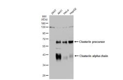 Anti-Clusterin alpha antibody used in Western Blot (WB). GTX134435