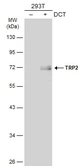 Anti-TRP2 antibody used in Western Blot (WB). GTX134445