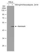Anti-Aurora A antibody used in Western Blot (WB). GTX134461