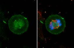 Anti-Aurora A antibody used in Immunocytochemistry/ Immunofluorescence (ICC/IF). GTX134467