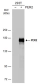 Anti-PER2 antibody used in Western Blot (WB). GTX134478