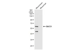 Anti-BACE1 antibody used in Western Blot (WB). GTX134480