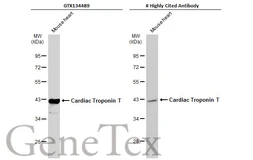Anti-Cardiac Troponin T antibody used in Western Blot (WB). GTX134489