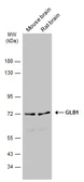 Anti-GLB1 antibody used in Western Blot (WB). GTX134513