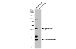 Anti-BDNF antibody used in Western Blot (WB). GTX134514