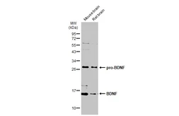 Anti-BDNF antibody used in Western Blot (WB). GTX134514