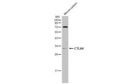 Anti-CTLA4 antibody used in Western Blot (WB). GTX134527
