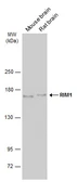 Anti-RIM1 antibody used in Western Blot (WB). GTX134539