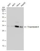 Anti-Tropomyosin 4 antibody used in Western Blot (WB). GTX134541