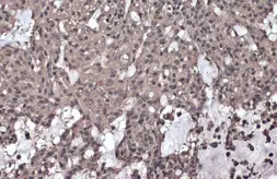 Anti-IKK gamma (phospho Ser376) antibody used in IHC (Paraffin sections) (IHC-P). GTX134550