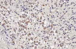 Anti-IL33 antibody used in IHC (Paraffin sections) (IHC-P). GTX134566