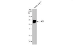 Anti-LAG3 antibody used in Western Blot (WB). GTX134573