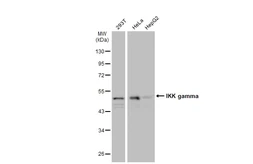 Anti-IKK gamma antibody used in Western Blot (WB). GTX134575