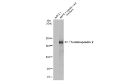 Anti-Thrombospondin 2 antibody used in Western Blot (WB). GTX134576