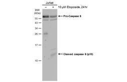 Anti-Caspase 8 p10 antibody used in Western Blot (WB). GTX134589