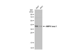 Anti-AMPK beta 1 antibody used in Western Blot (WB). GTX134594