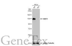 Anti-SIRT1 antibody used in Western Blot (WB). GTX134606