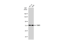 Anti-TAK1 antibody used in Western Blot (WB). GTX134664