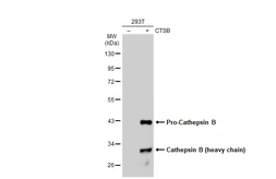 Anti-Cathepsin B antibody used in Western Blot (WB). GTX134724