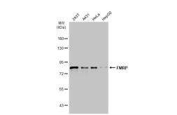 Anti-FMRP antibody used in Western Blot (WB). GTX134734