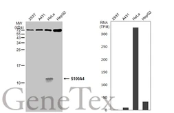 Anti-S100A4 antibody used in Western Blot (WB). GTX134743